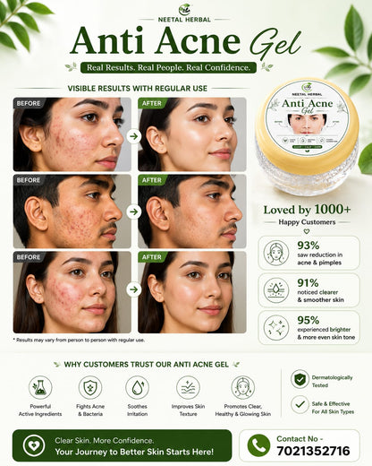 Anti Acne Gel